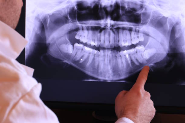 Best Emergency Dentist for Lost Fillings or Crowns in North Druid Hills, GA